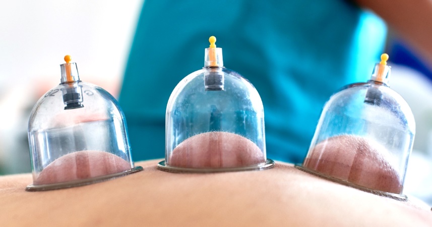 Bienfaits thérapeutiques de la Hijama